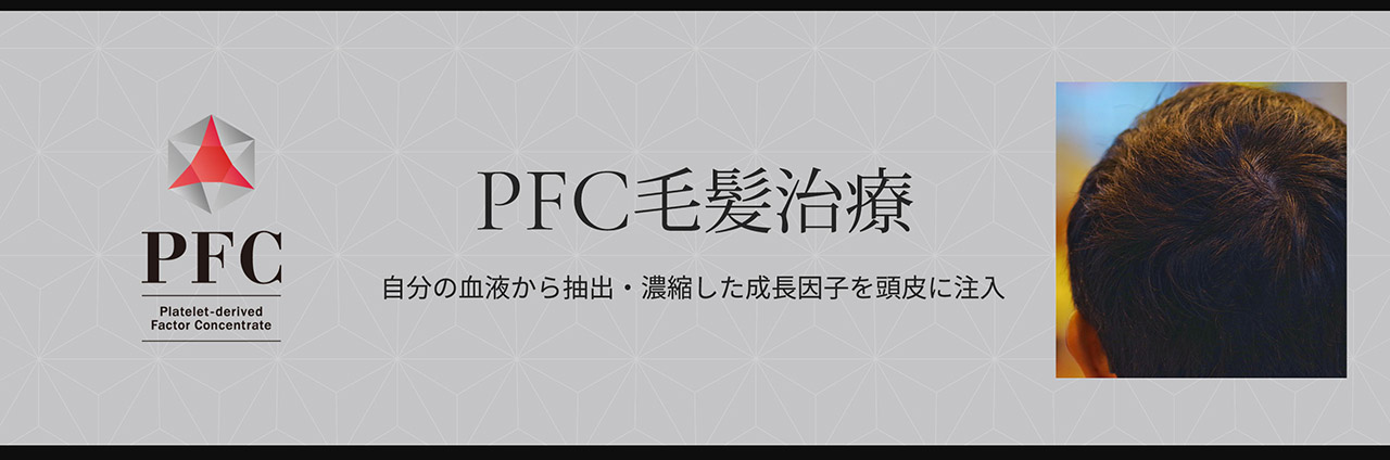 PFC毛髪治療 自分の血液から抽出・濃縮した成長因子を頭皮に注入