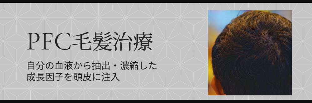 PFC毛髪治療 自分の血液から抽出・濃縮した成長因子を頭皮に注入