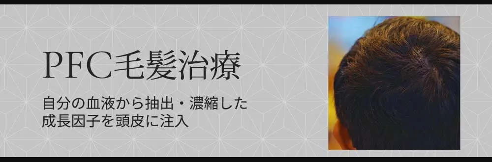PFC毛髪治療 自分の血液から抽出・濃縮した成長因子を頭皮に注入